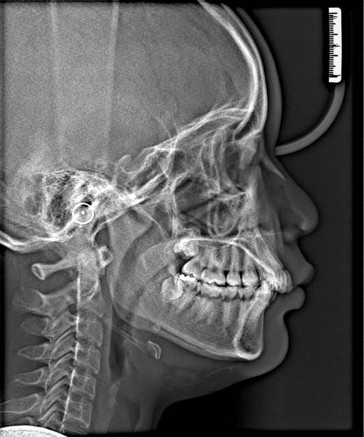 istock X-ray film Head and mouth 1080546944