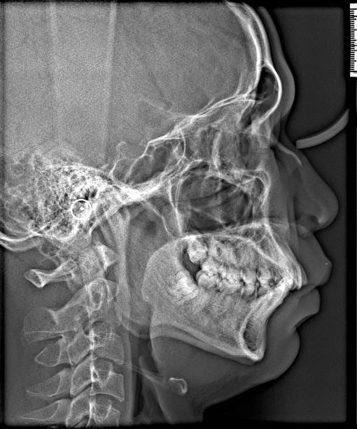 istock X-ray film Head and mouth 1080547734