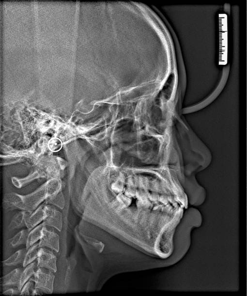 istock X-ray film Head and mouth 1080548096