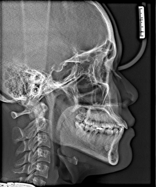 istock X-ray film Head and mouth 1080548442