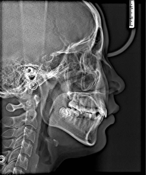istock X-ray film Head and mouth 1080548654
