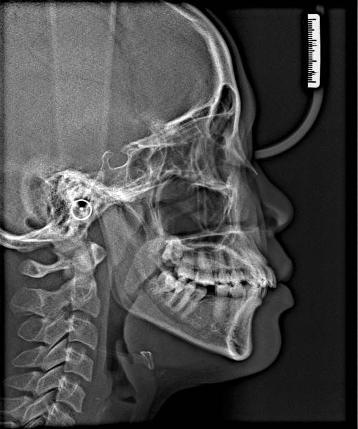 istock X-ray film Head and mouth 1080548766