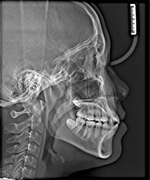 istock X-ray film Head and mouth 1080552310