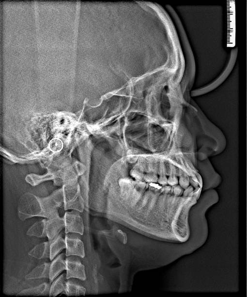 istock X-ray film Head and mouth 1080553486