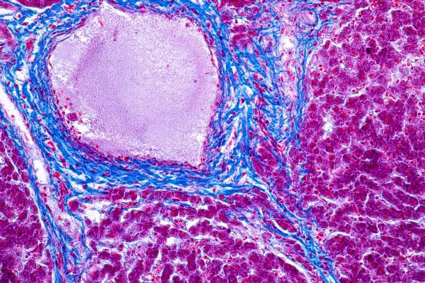 tejido del hígado bajo el microscopio para la educación en fisiología de laboratorio. - laboratory healthcare and medicine cancer drug histology fotografías e imágenes de stock