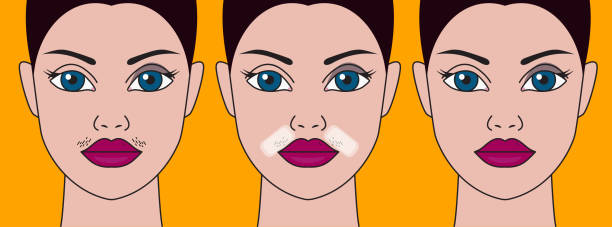 ilustraciones, imágenes clip art, dibujos animados e iconos de stock de bigote de las niñas, defecto cosmético - human skin sparse washing face human face