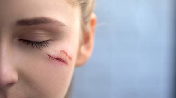 Close up of young female face with deep scars, domestic violence victim, pain Close up of young female face with deep scars, domestic violence victim, pain scar stock pictures, royalty-free photos & images
