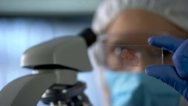 assistente di laboratorio che guarda lo scivolo al microscopio con sangue, ricerca genetica, primo piano - microscope slide foto e immagini stock