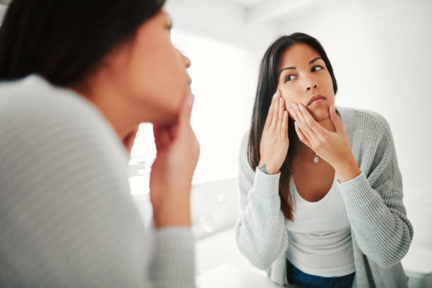 istock Do I have any blemishes? 1081913634