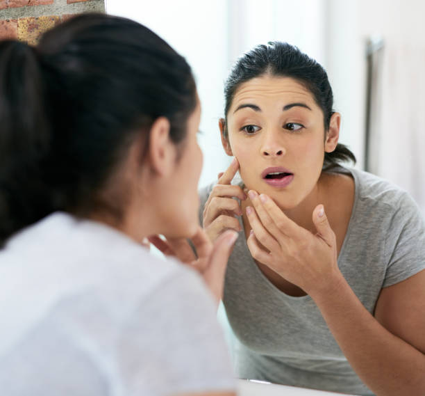 istock I have clear skin because I keep it clear 1081970798