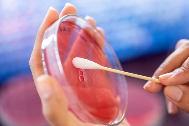 badanie na obecność bakterii (staphylococcus aureus) w nosie człowieka, do badań na blood agar culture plate w lab microbiology. - microbiological culture zdjęcia i obrazy z banku zdjęć