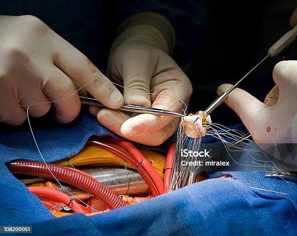 Chirurgia Serca Zastawka Aortalna Zastępczego - zdjęcia stockowe i więcej obrazów Aorta - Aorta, Operacja chirurgiczna, Chirurg