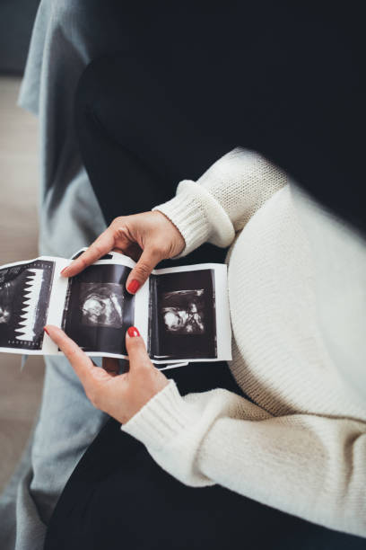 istock Woman looking at her baby sonography 1082040872