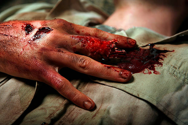 wojskowych mężczyzna z czego palec - wound blood human finger physical injury zdjęcia i obrazy z banku zdjęć
