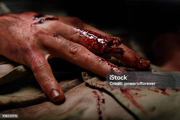 Militärische Mann Mit Severed Finger Stockfoto und mehr Bilder von Verletzung - Verletzung, Wunde, Menschliches Blut