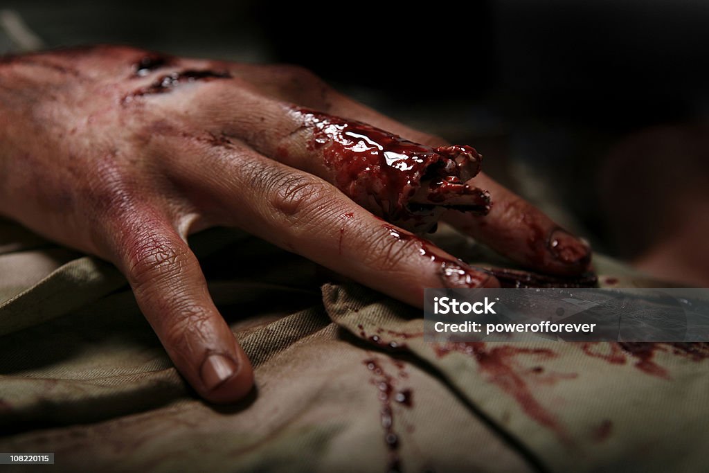 군용동물에는 남자의 손가락 절단 - 로열티 프리 부상 스톡 사진