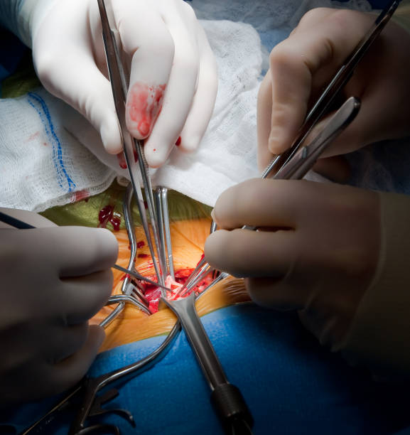 сосудистая хирургия каротидная эндартерэктомия - surgery human artery human hand carotid artery стоковые фото и изображения