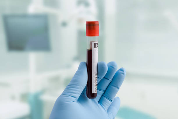 doctor's hand with blood probe doctor's hand is holding a blood probe in front of clinic room test tube stock pictures, royalty-free photos & images