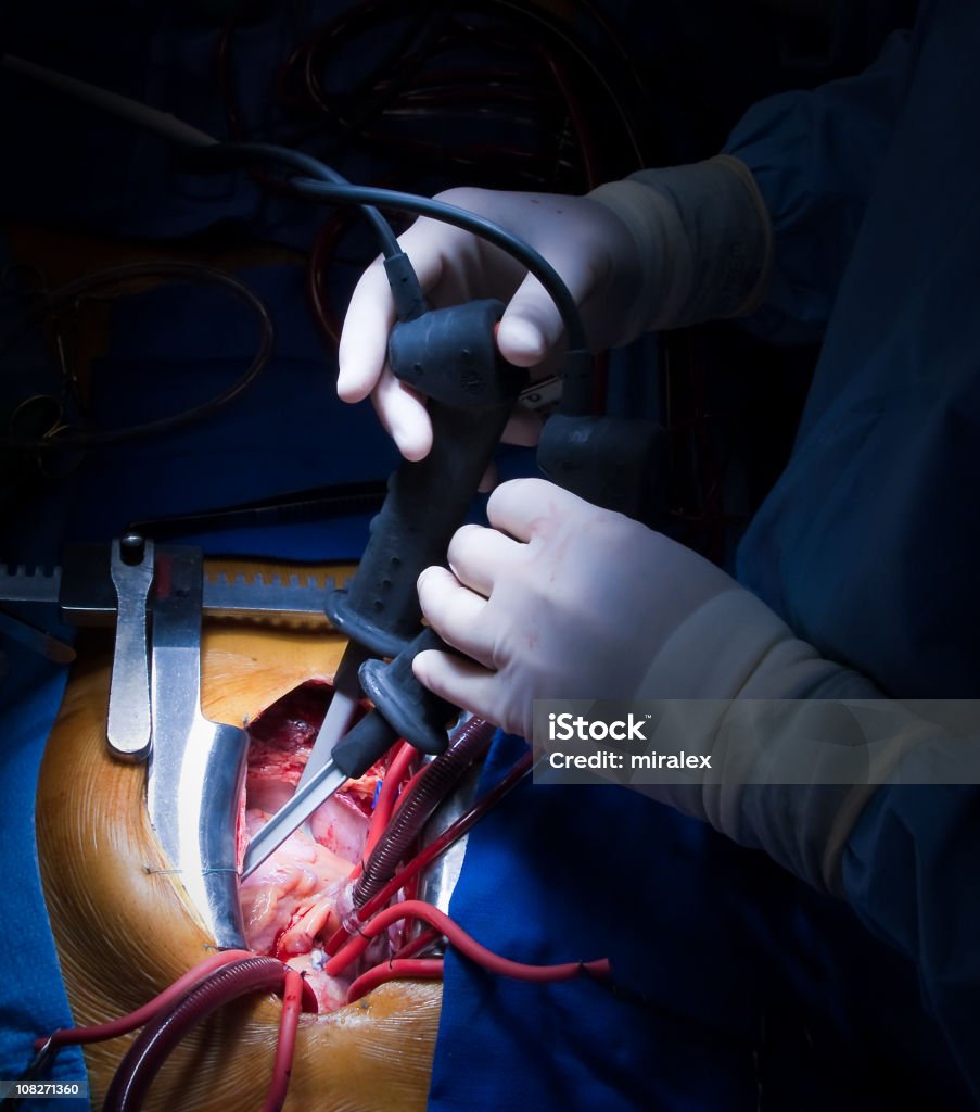 Heart Surgery - Cardiac Defibrillation  High Angle View Stock Photo