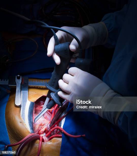 Heart Surgery Cardiac Defibrillation Stock Photo - Download Image Now - High Angle View, Color Image, Doctor