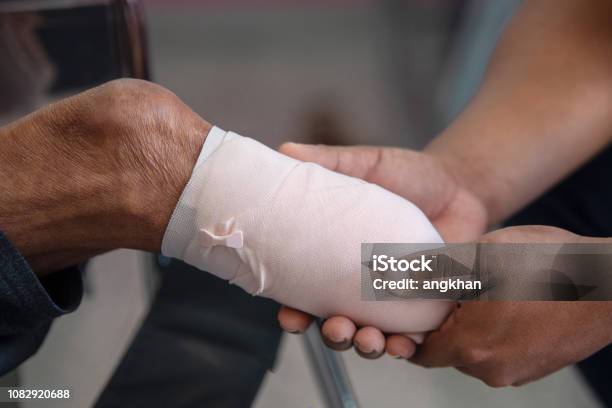 Below Knee Amputation Patient With Elastic Bandaging Stock Photo - Download Image Now