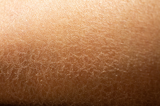 Woman's dry skin on leg, Close up & Macro shot, Asian skin tone, Abstract background