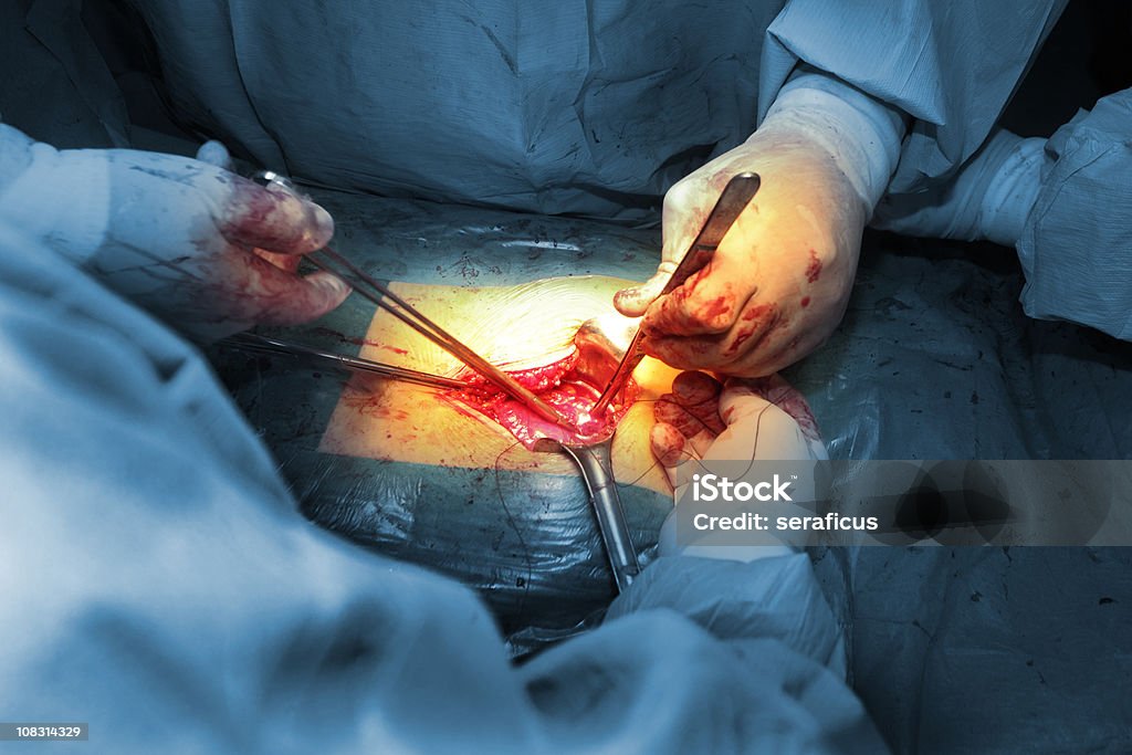 La cirugía - Foto de stock de Cirugía libre de derechos