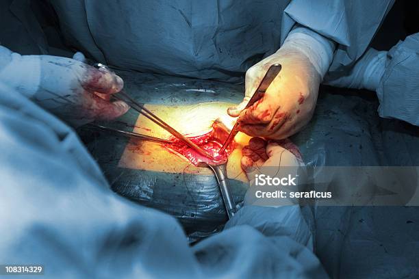 La Cirugía Foto de stock y más banco de imágenes de Cirugía - Cirugía, Abierto, Herida