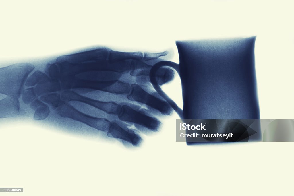 Imagerie par rayons X avec une tasse de café à la main et XXXL - Photo de Syndrome du tunnel carpien libre de droits