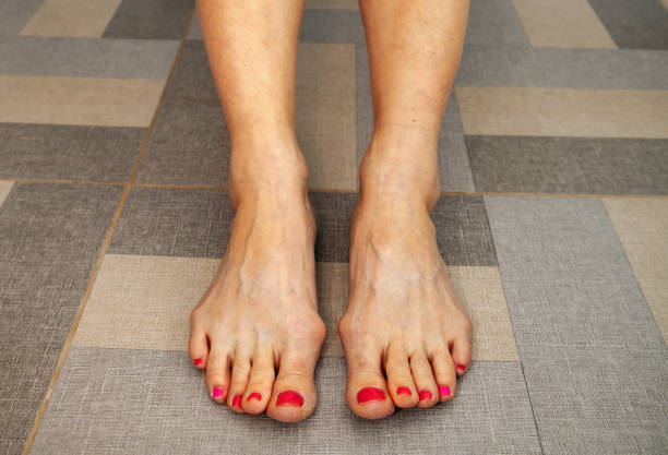 istock peeling of skin 1083378894