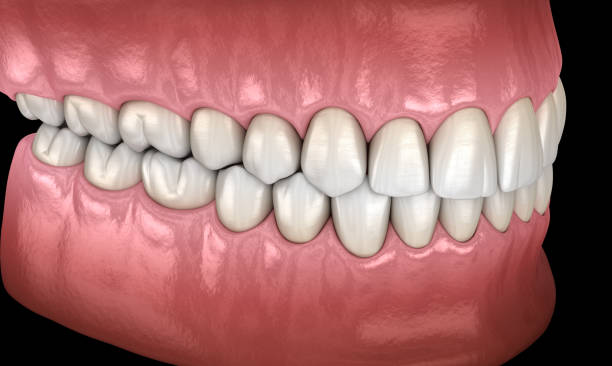 istock Healthy human teeth with normal occlusion, side view. Medically accurate tooth 3D illustration 1083775966