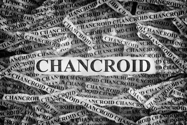 istock Torn pieces of paper with the words Chancroid 1084083938