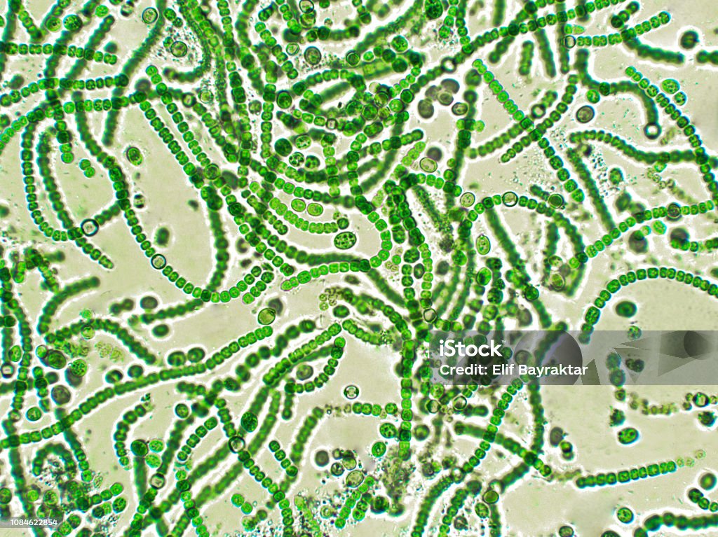 Nostoc sp. algae under microscopic view Nostoc is a genus of cyanobacteria found in various environments that forms colonies composed of filaments of moniliform cells in a gelatinous sheath. Cyanobacterium Stock Photo