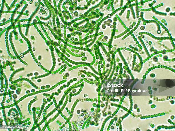 Nostoc Sp Algae Under Microscopic View Stock Photo - Download Image Now - Cyanobacterium, Microscope, Biological Cell