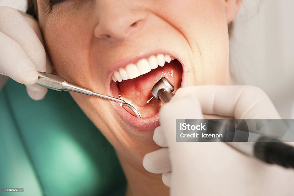 Paciente no dentista-tratamento dentário - Royalty-free Adulto Foto de stock