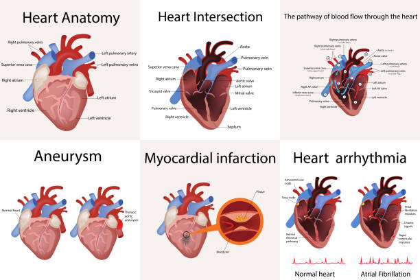 herzanatomie und arten von herz-kreislauferkrankungen-vektor-illustration - herzkammer stock-grafiken, -clipart, -cartoons und -symbole