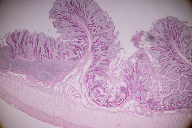 Tissue of small intestine or small bowel under the microscopic in Lab. Tissue of small intestine or small bowel under the microscopic in Lab. epithelium photos stock pictures, royalty-free photos & images