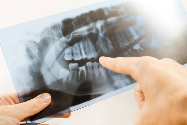 istock to study an x-ray of teeth 1085065856