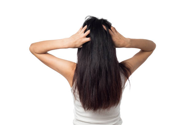 istock female itching scalp itchy his hair on a white background 1085669334