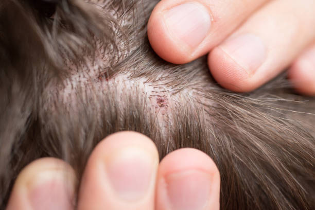 istock Scalp injury due to cat claws macro shot 1085981910