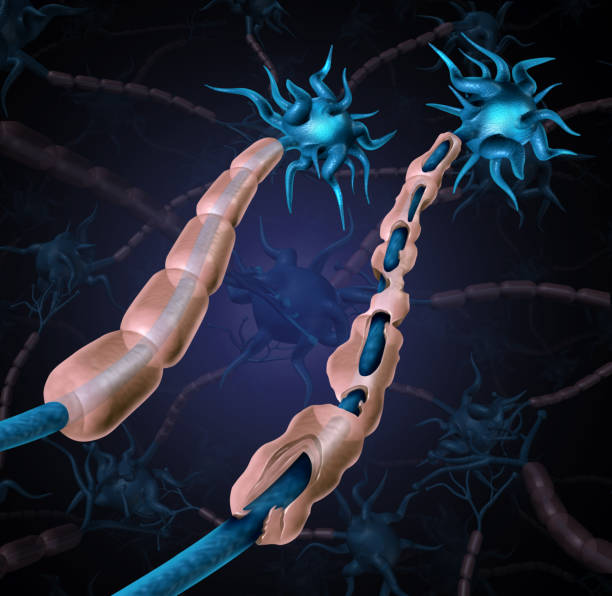 multiple sclerosis damaged myelin - axon imagens e fotografias de stock