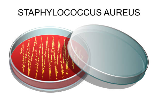 illustrazioni stock, clip art, cartoni animati e icone di tendenza di illustrazione vettoriale di una cultura di staphylococcus aureus in una piastra di petri - bacterium staphylococcus colony epidemic