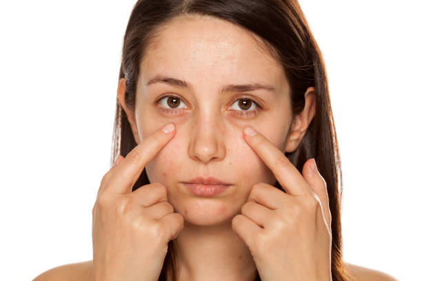 istock Beautiful young woman touch her face under eyes on white background 1086566830