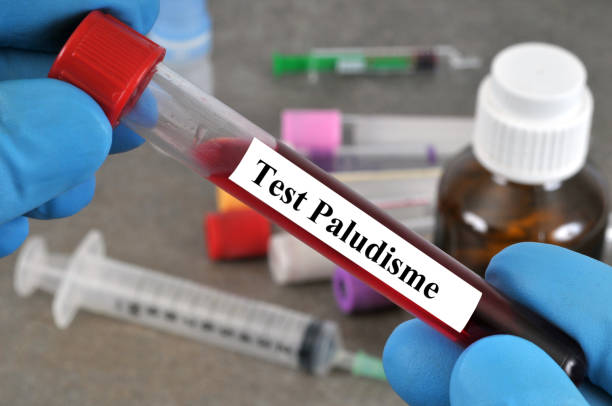 Malaria test Malaria screening test in close-up malaria blood sample stock pictures, royalty-free photos & images