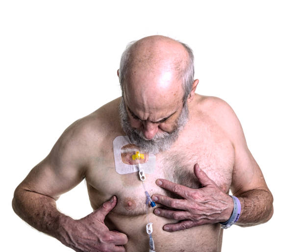 Cancer Chemotherapy Patient Examining Iv Chest Port Stock Photo