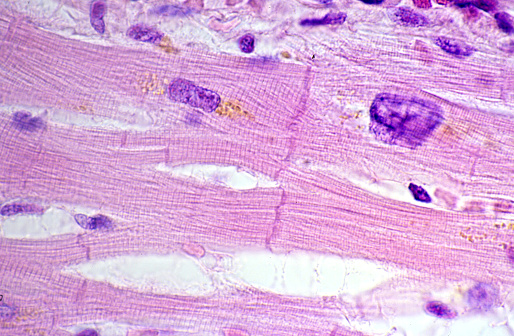 Striated cardiac myocytes showing yellow pigment lipofuscin granules near the central nucleus. The myocytes are joined by intercalated disks. Light micrograph. H&E stain.