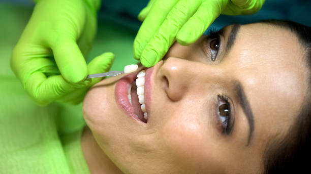 Everything You Need to Know About Porcelain Veneers and Smile Makeovers