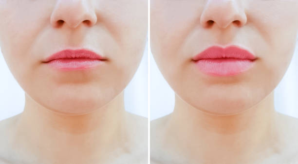 girl lips before and after magnification girl lips before and after magnification human lips stock pictures, royalty-free photos & images