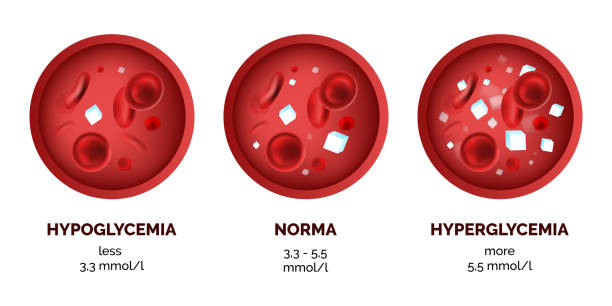 Infographic image of blood sugar levels isolated on white Infographic image of blood sugar levels isolated on white background. Realistic vector 3d picture of human hypoglycemia and hyperglycemia anemia diagram stock illustrations