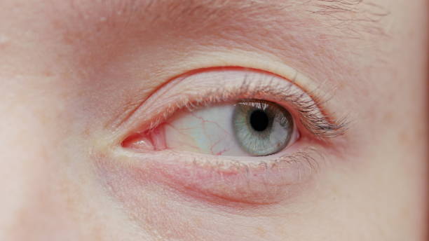 istock Close-up Beautiful Blue Eye 1087647226